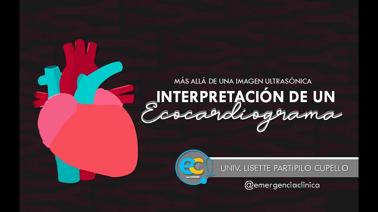 INTERPRETACIÓN de un ECOCARDIOGRAMA