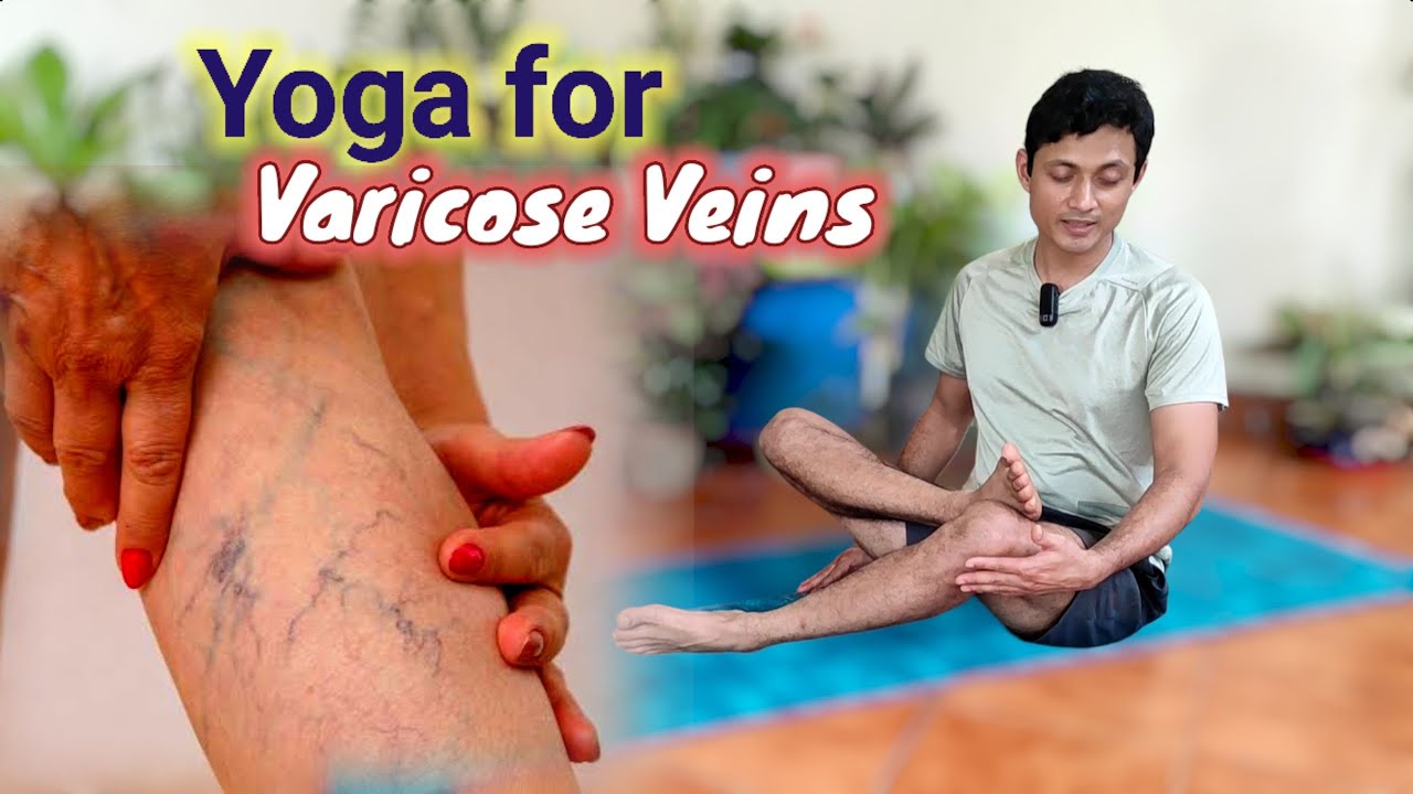 Yoga Varicose Vein Cure (7 Yogic Stretches)