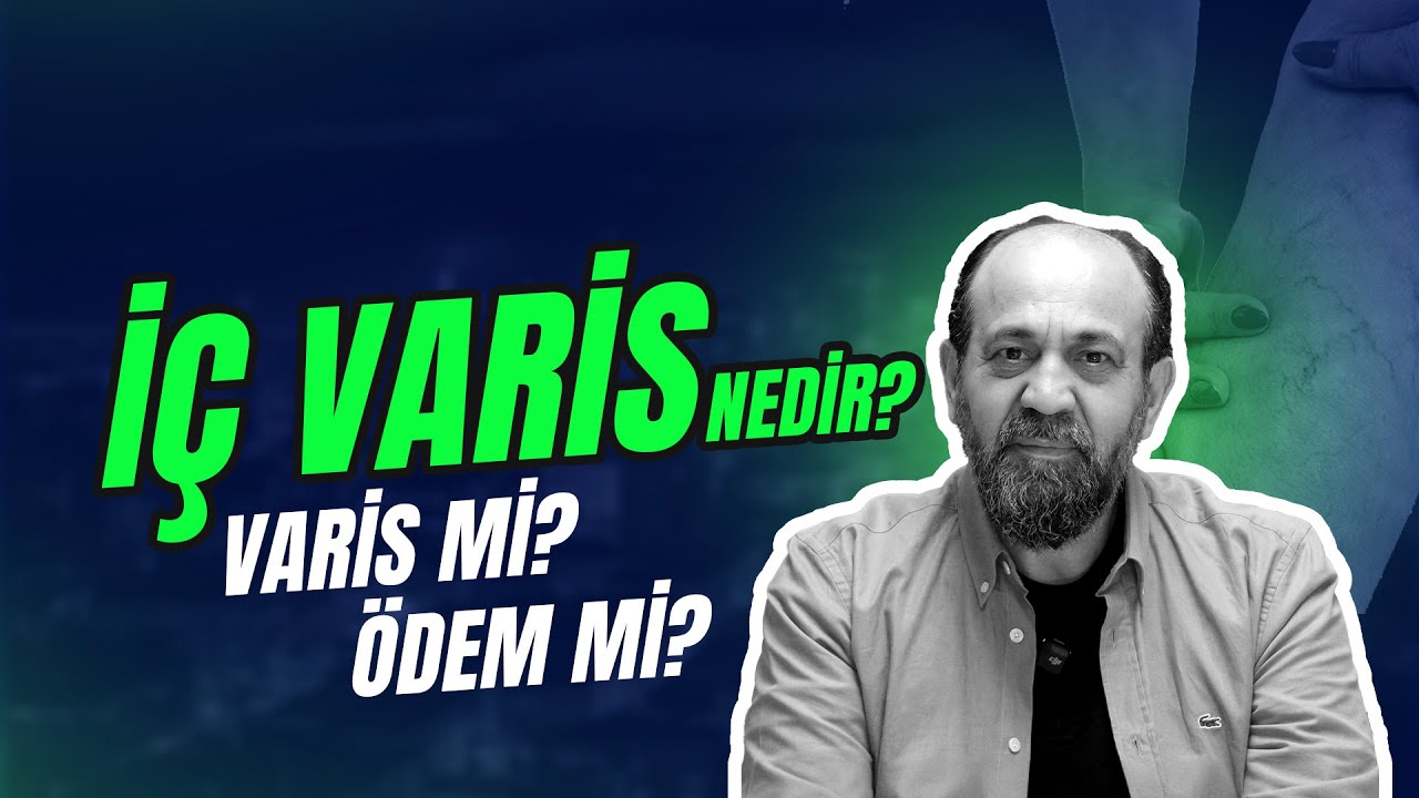 İÇ VARİS NEDİR? İÇ VARİS Mİ? ÖDEM Mİ?