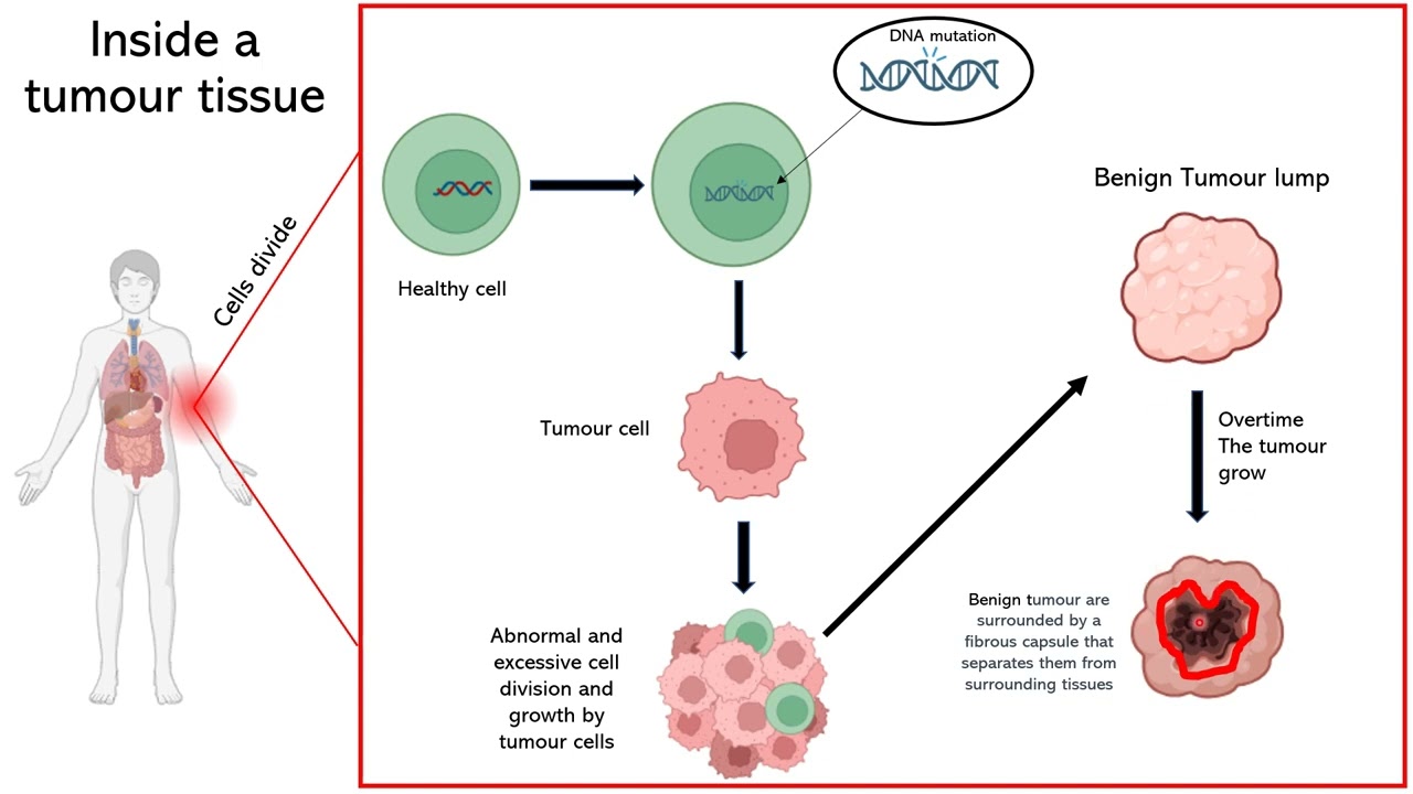 How Healthy Tissues Become Cancerous? (Secrets you MUST know !!)