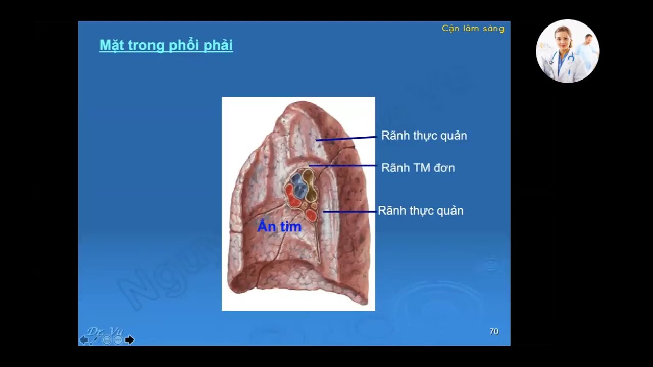 PHỔI | Ôn thi SĐH | TS. BS. Nguyễn Hoàng Vũ