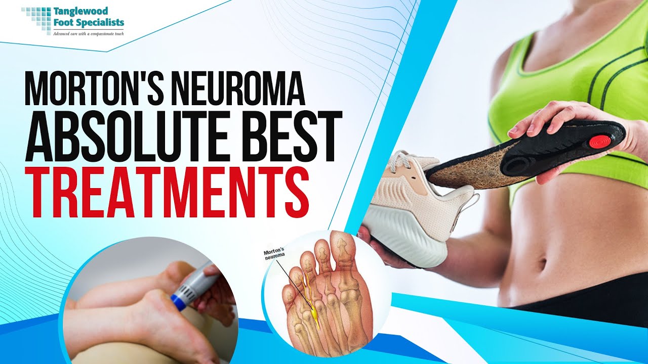 Morton's Neuroma: Absolute Best Treatments