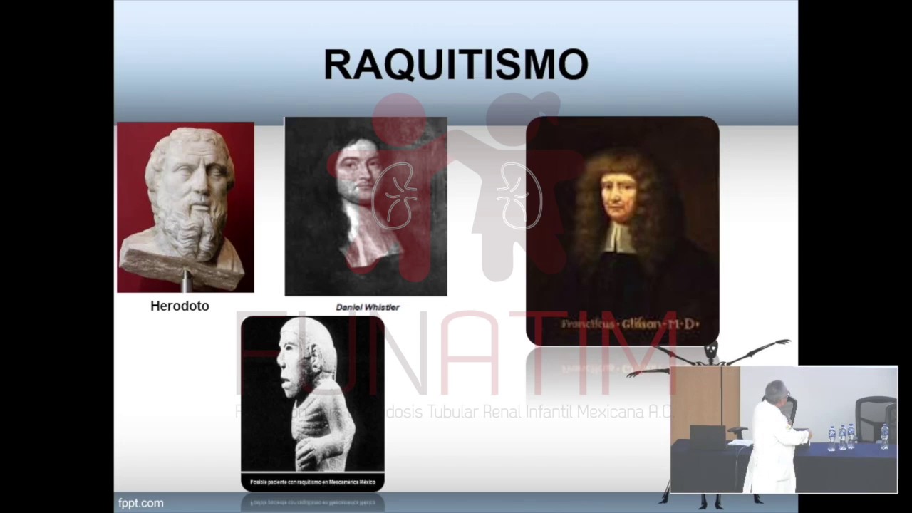 Raquitismo hipofosfatémico