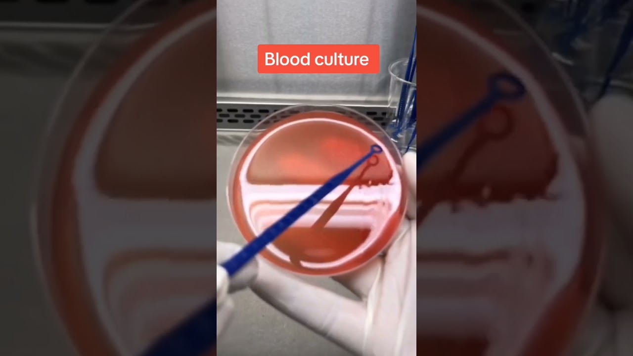 Blood culture and sensitivity test #microbiology#microbiologist #laboratory  #phd #microbiologylab