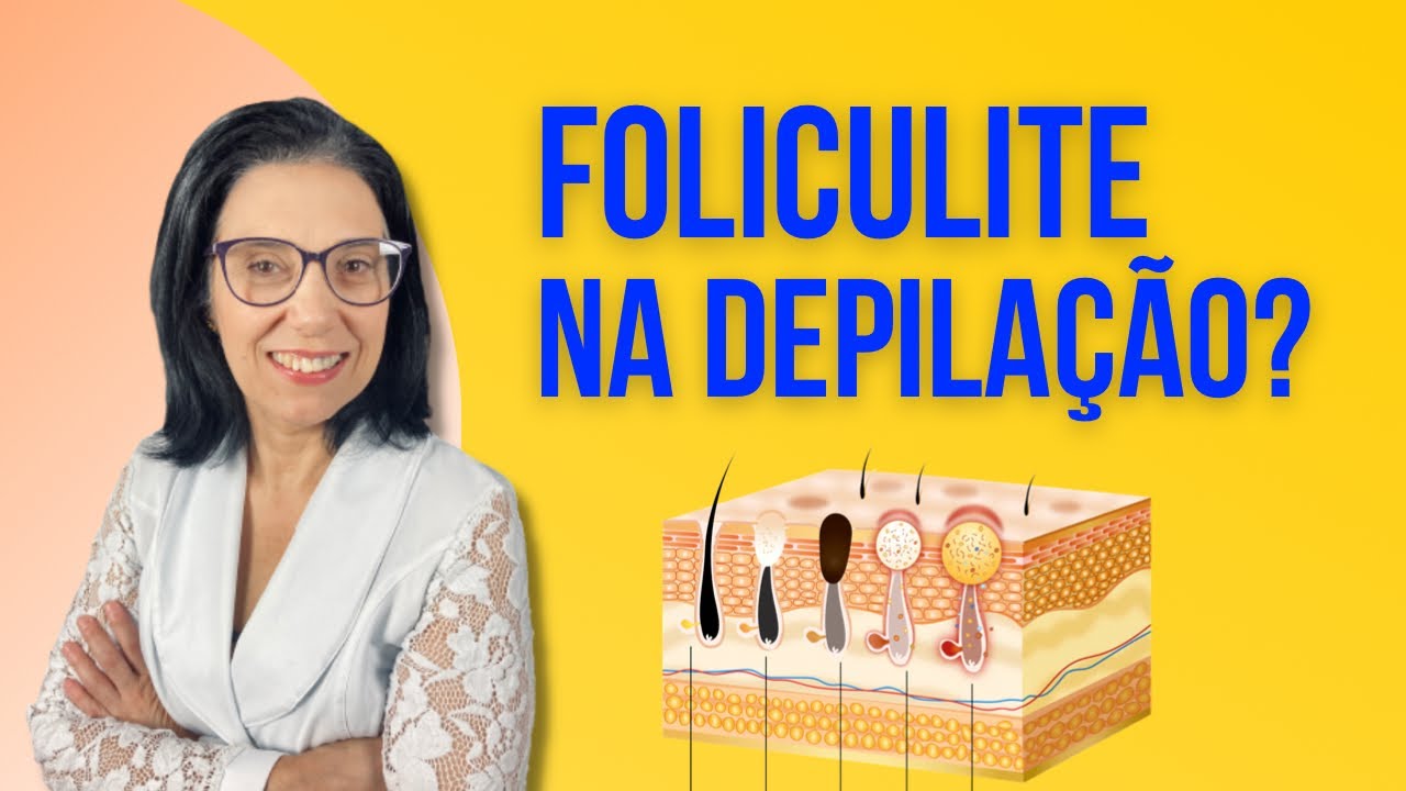 FOLICULITE na DEPILAÇÃO QUAIS as CAUSAS e PORQUE ACONTECE ISSO COM a NOSSA PELE ?