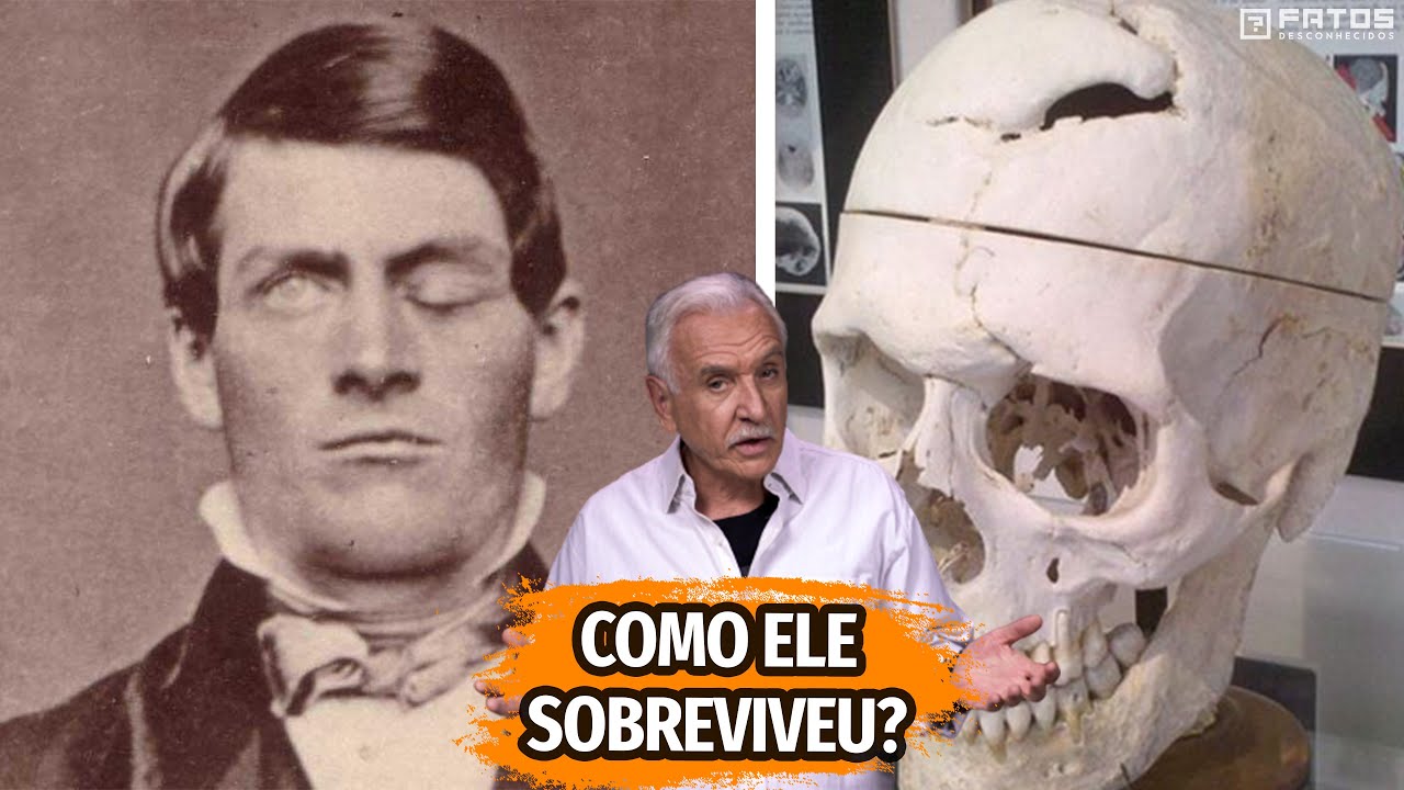 Phineas Gage: um milagre da medicina ou sorte?
