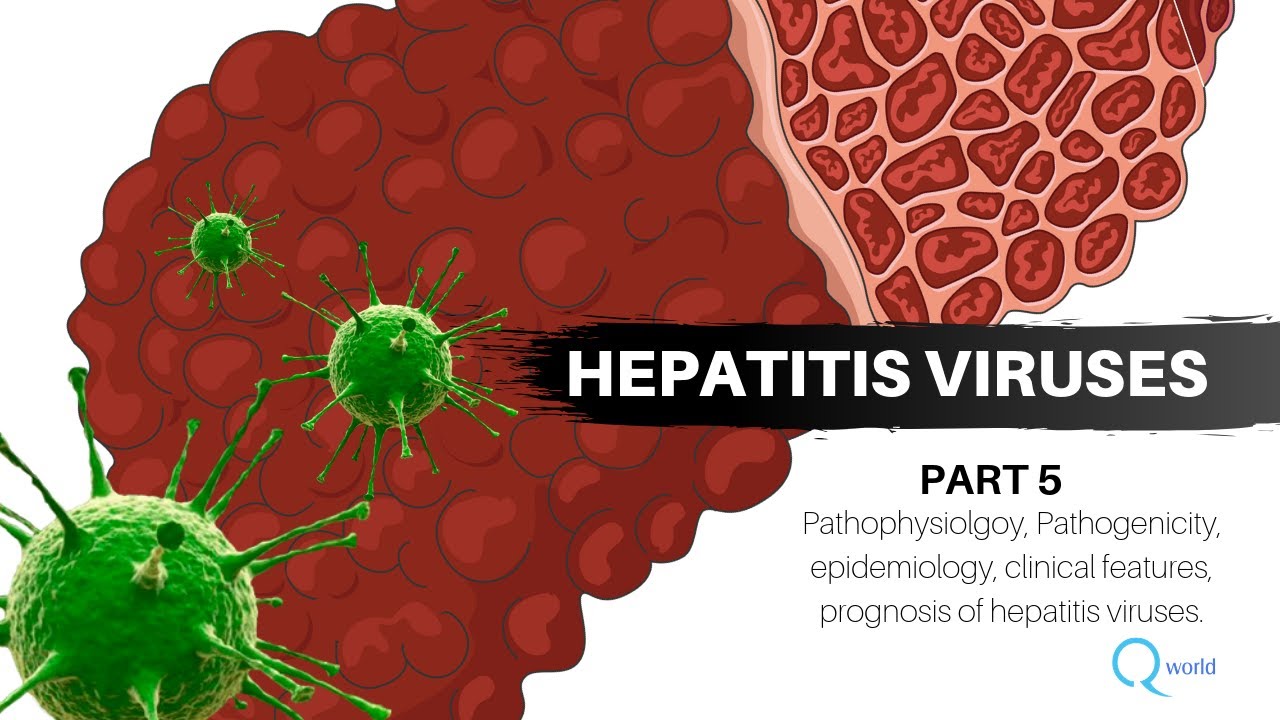 Hepatitis viruses part 5 of 6: Review for USMLE and NEXT/NEET-PG