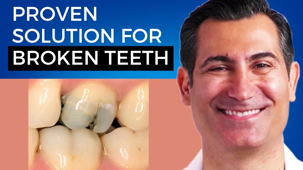 The Top Reasons You Should NOT DO Bandage Dentistry (Prosper, Texas)