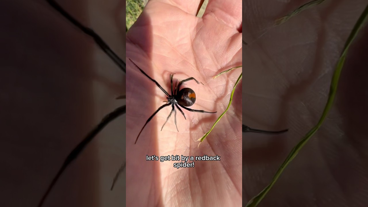 I GOT BIT BY A REDBACK SPIDER! #shorts