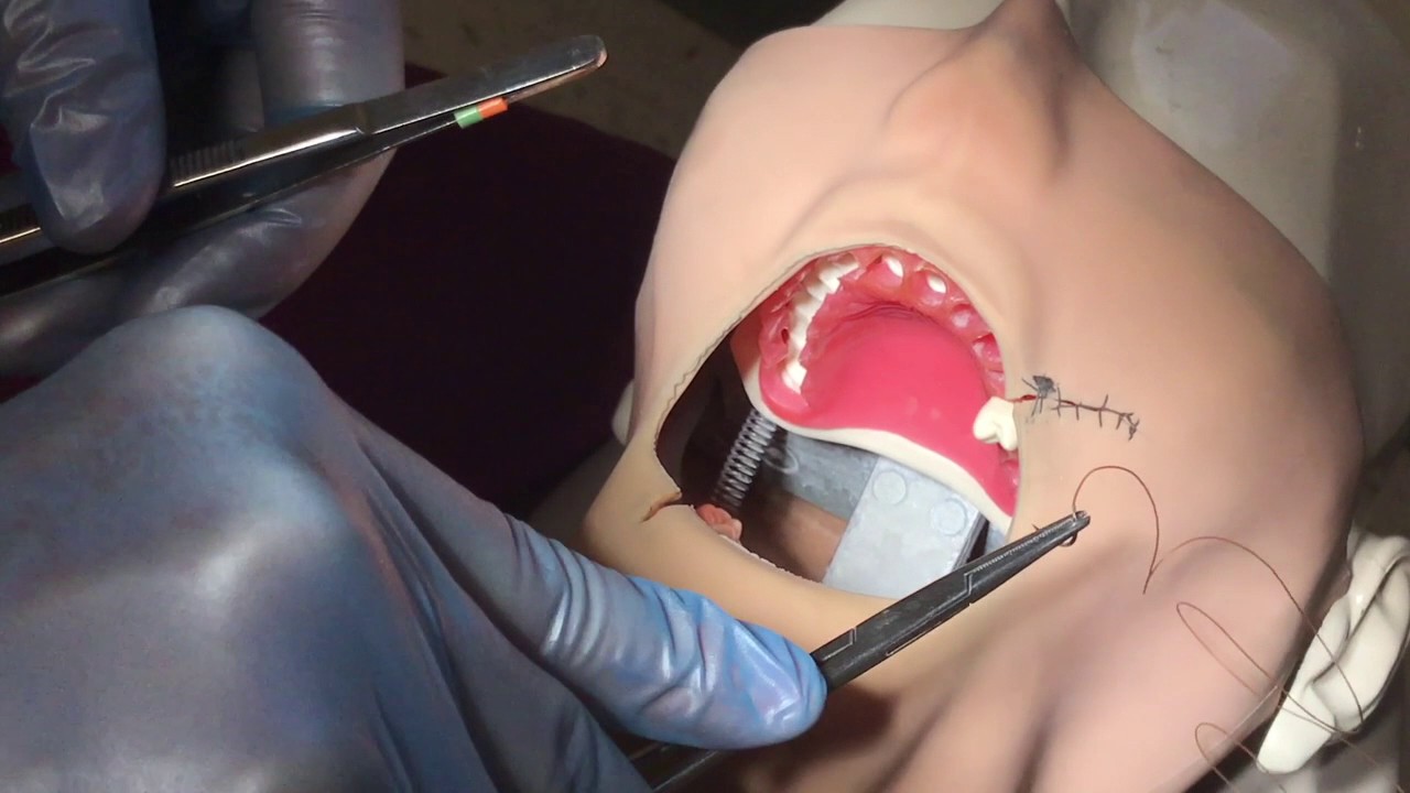 Dental Suturing 101: Safety, Selection, & Ergonomics