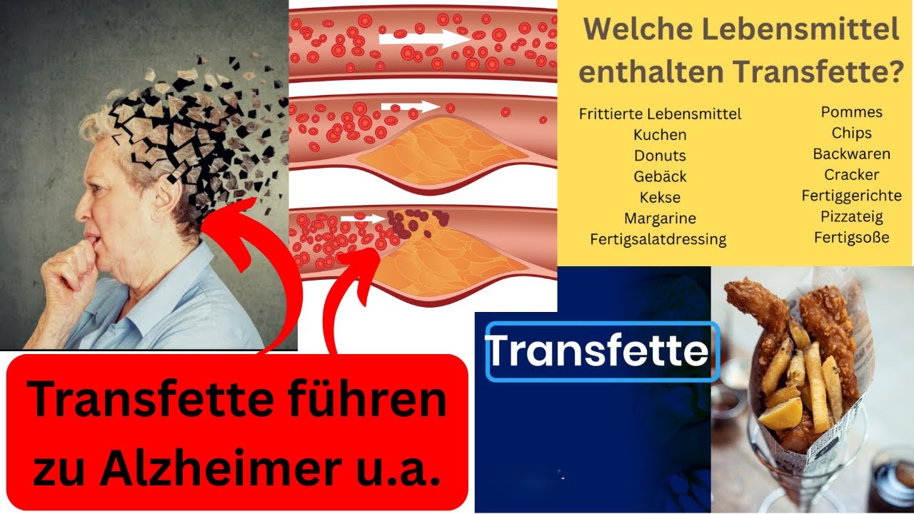 Dieser einzigartige Nährstoff kann Transfette entgiften!