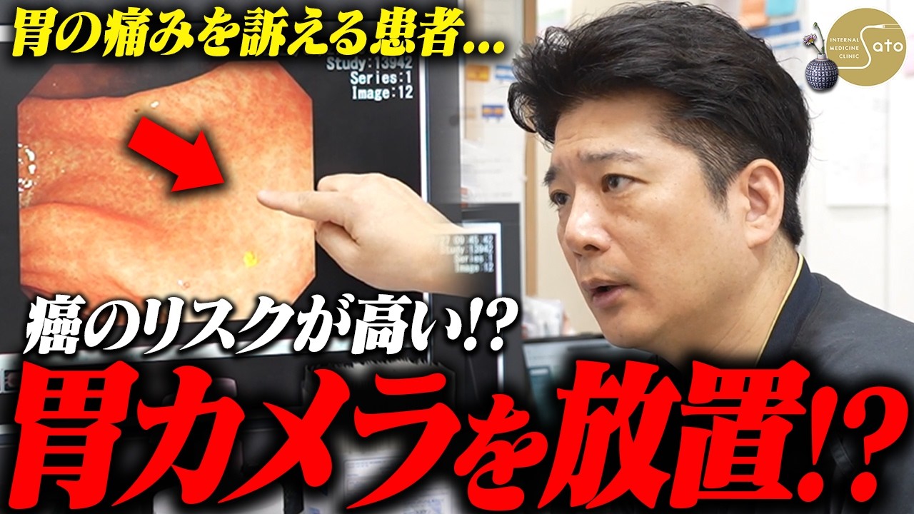 【放置厳禁】『4年間、胃カメラを放置！？』胃痛を訴える患者... 医師がピロリ菌の除菌後の検査の重要性を訴えかける！