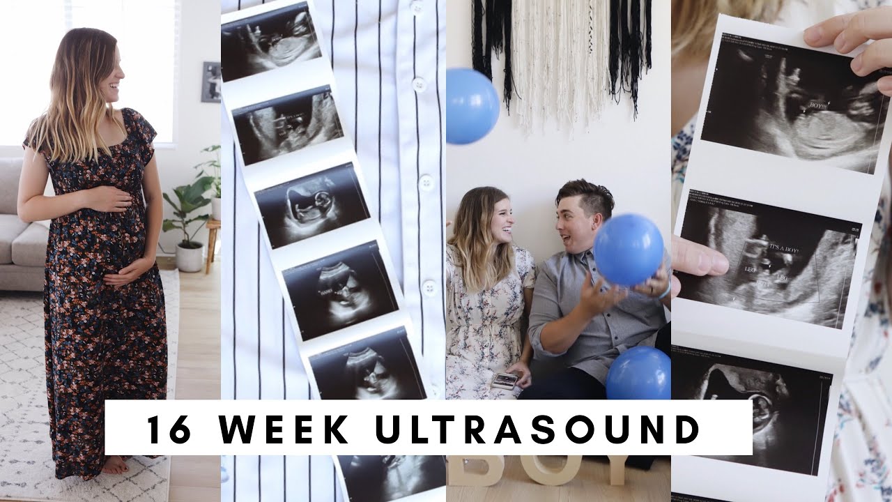16 WEEK ULTRASOUND (ITS A BOY!!)