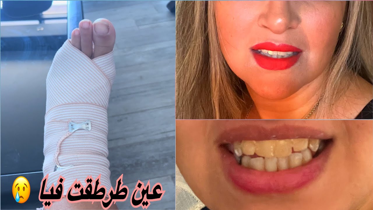 حققت حلمي و تخلصت من أكبر عقدة في حياتي🥹أحسن طبيبة أسنان فالجزائر🤩ضيف جديد معاكم هل من ترحيب🐱