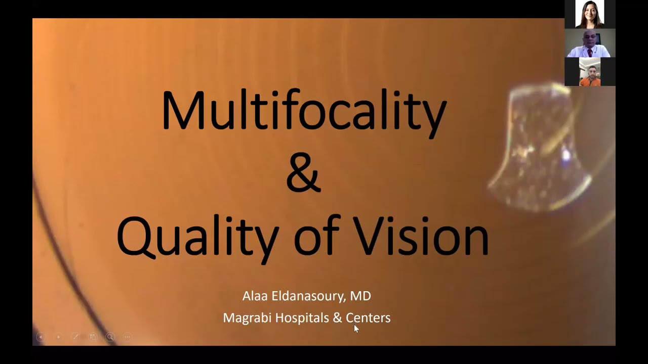 «Multifocality and Quality of vision» by Dr. Alaa Eldanasoury