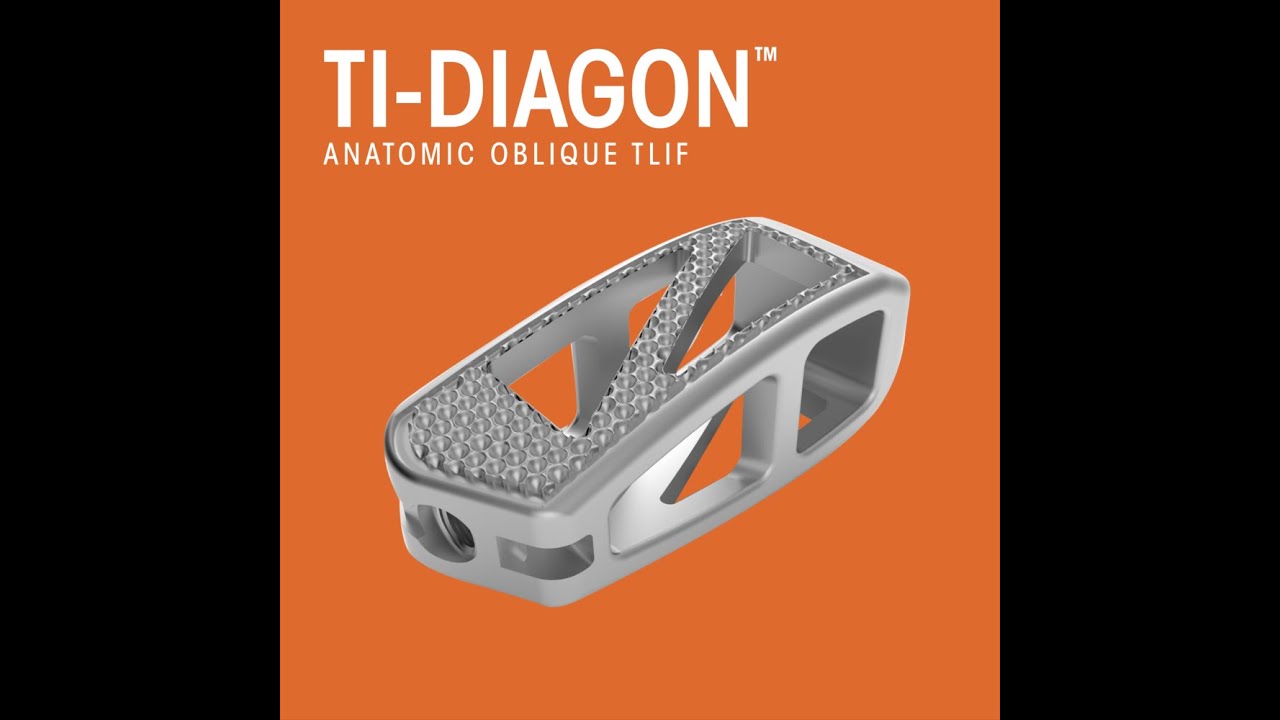 Camber Spine: Ti Diagon Anatomic Oblique TLIF