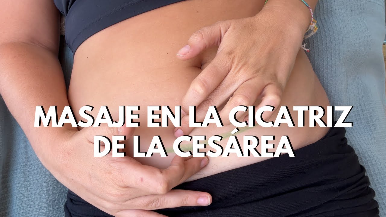 MASAJE EN LA CICATRIZ DE LA CESÁREA | Guía paso a paso para hacerlo en casa