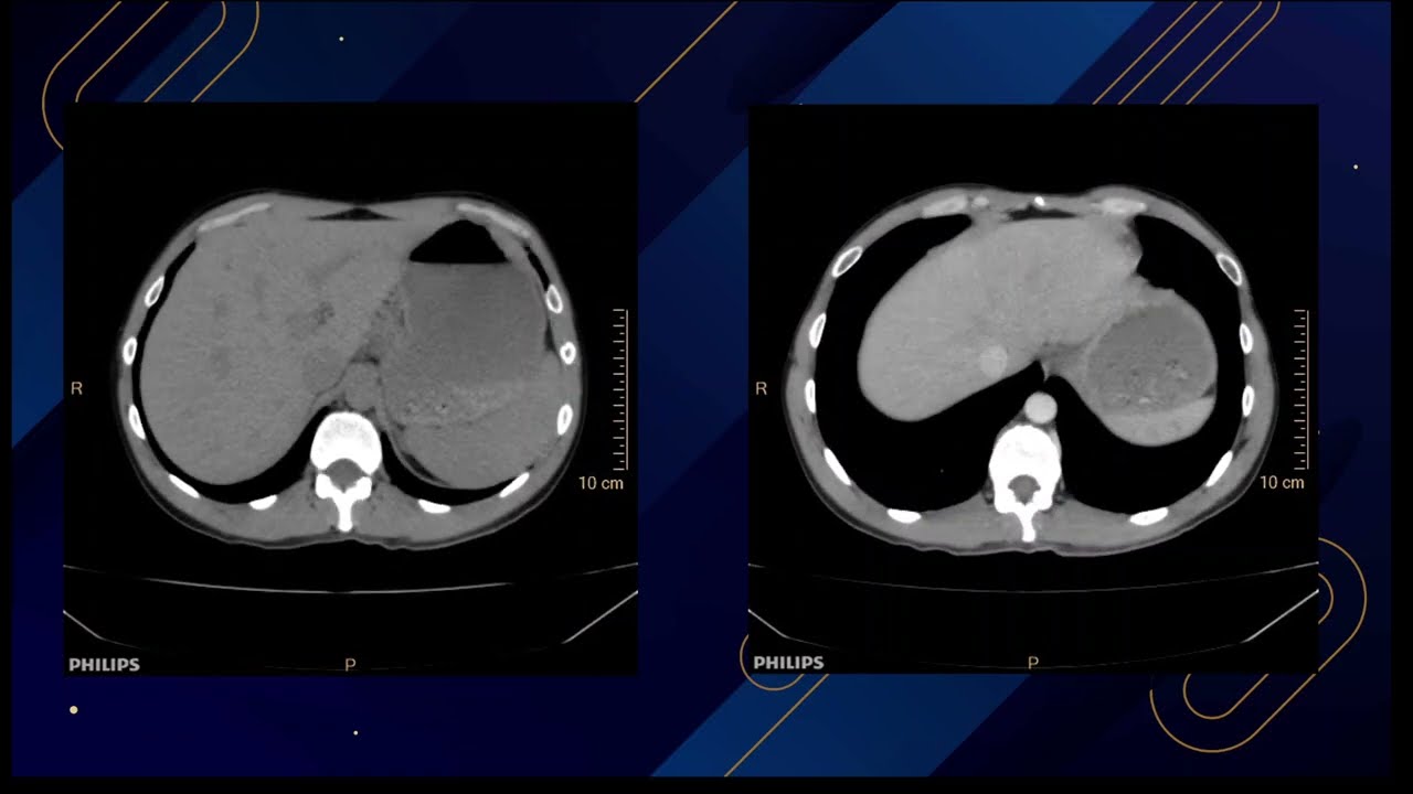 Caso del Mes n°211 Abril 2025 