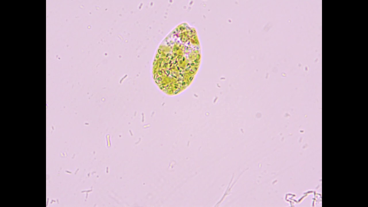 Euglena Under Microscope (1000x)