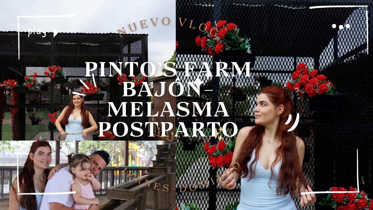 Melasma Postparto | mi fin de semana entre estética y lluvia | Granja