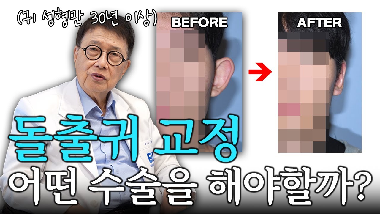 생각보다 큰 콤플레스 '돌출 귀' 교정수술 후회 안하는 이유