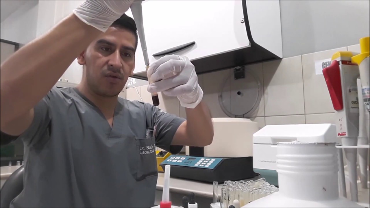 BANCO DE SANGRE, PRUEBAS PRE TRANSFUSIONALES #1