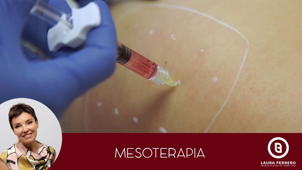 Mesoterapia - Dott. Laura Ferrero - Medicina Estetica Torino