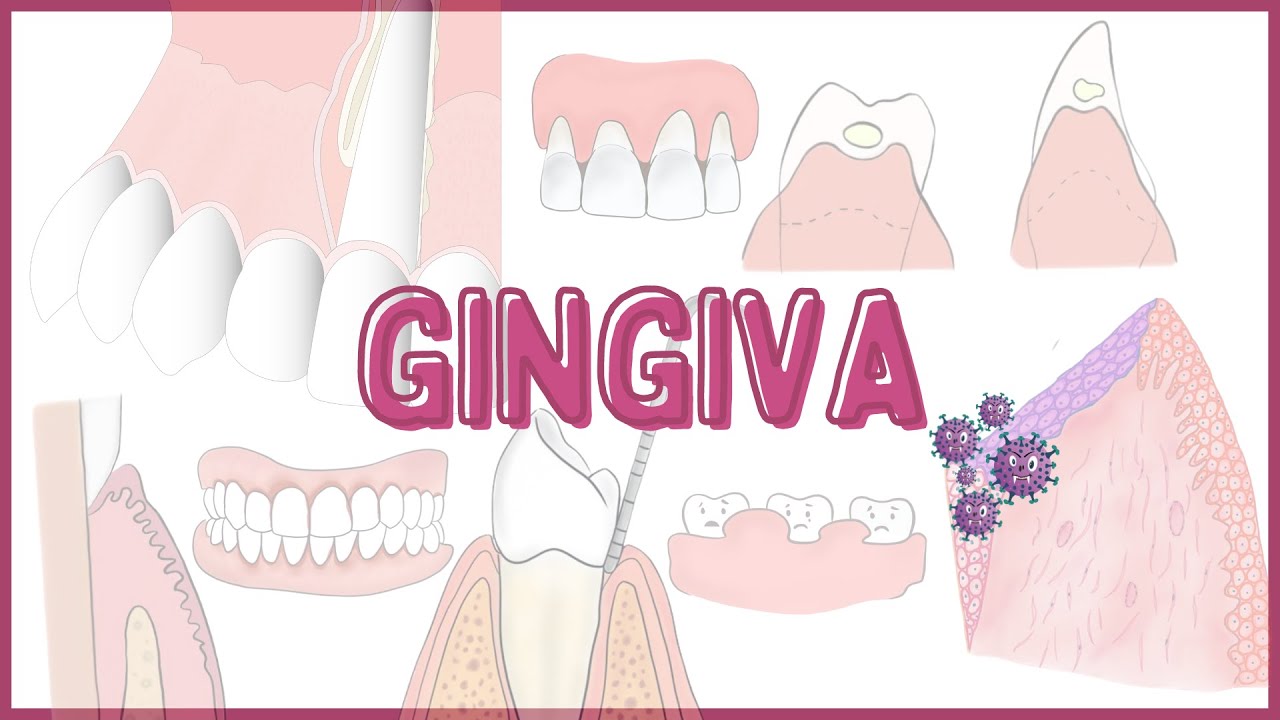 Gingiva-Macroscopic features