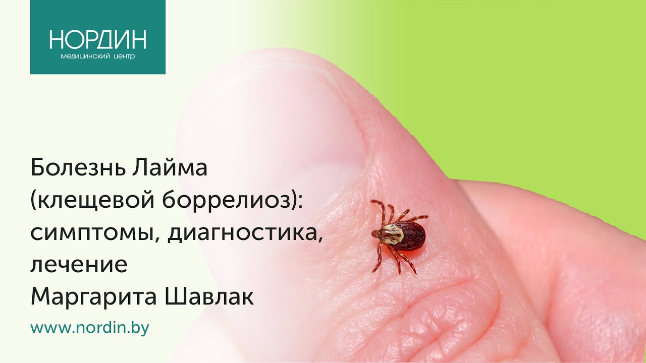 Болезнь Лайма (клещевой боррелиоз): симптомы, диагностика, лечение