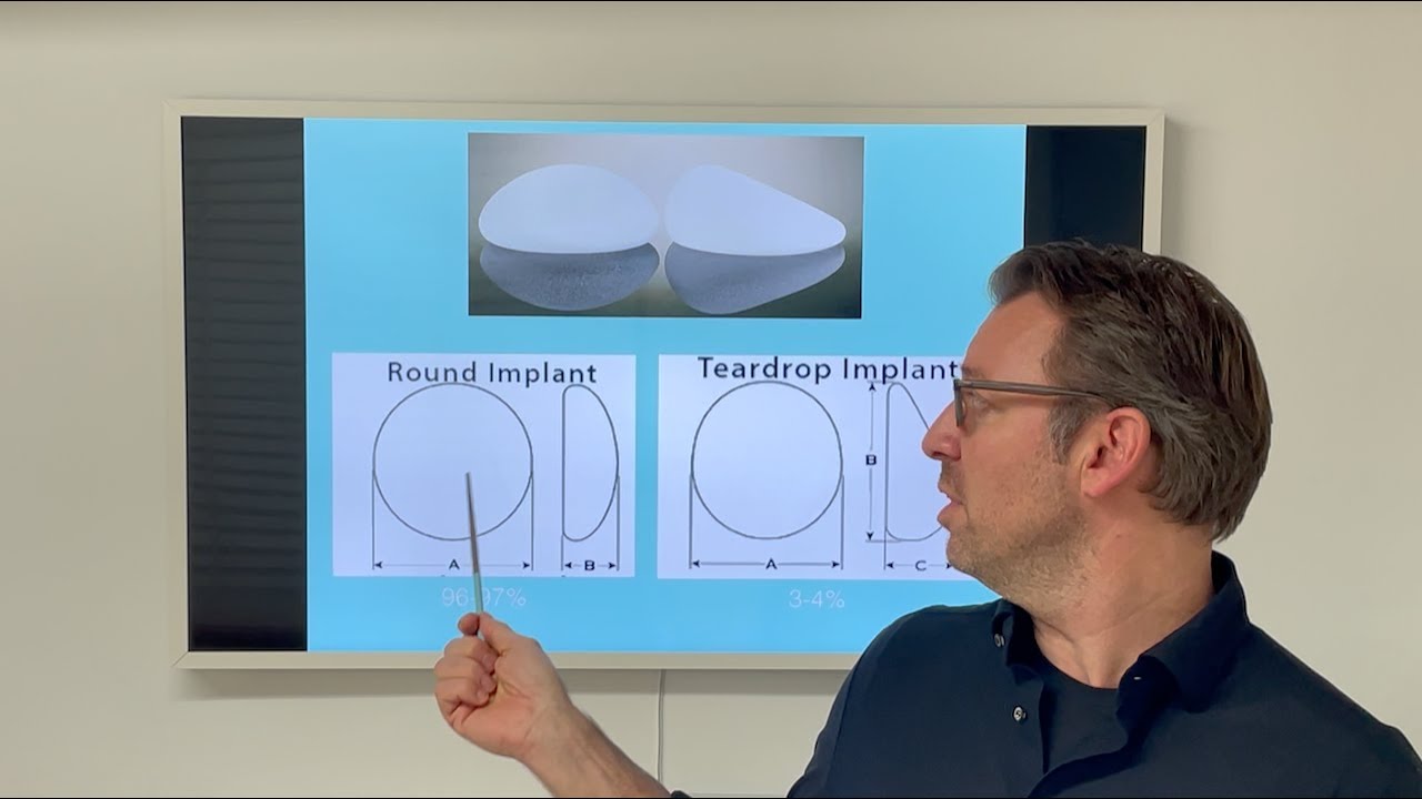 Brustimplantate: Formen und nat&uuml;rliche Brust - der Unterschied