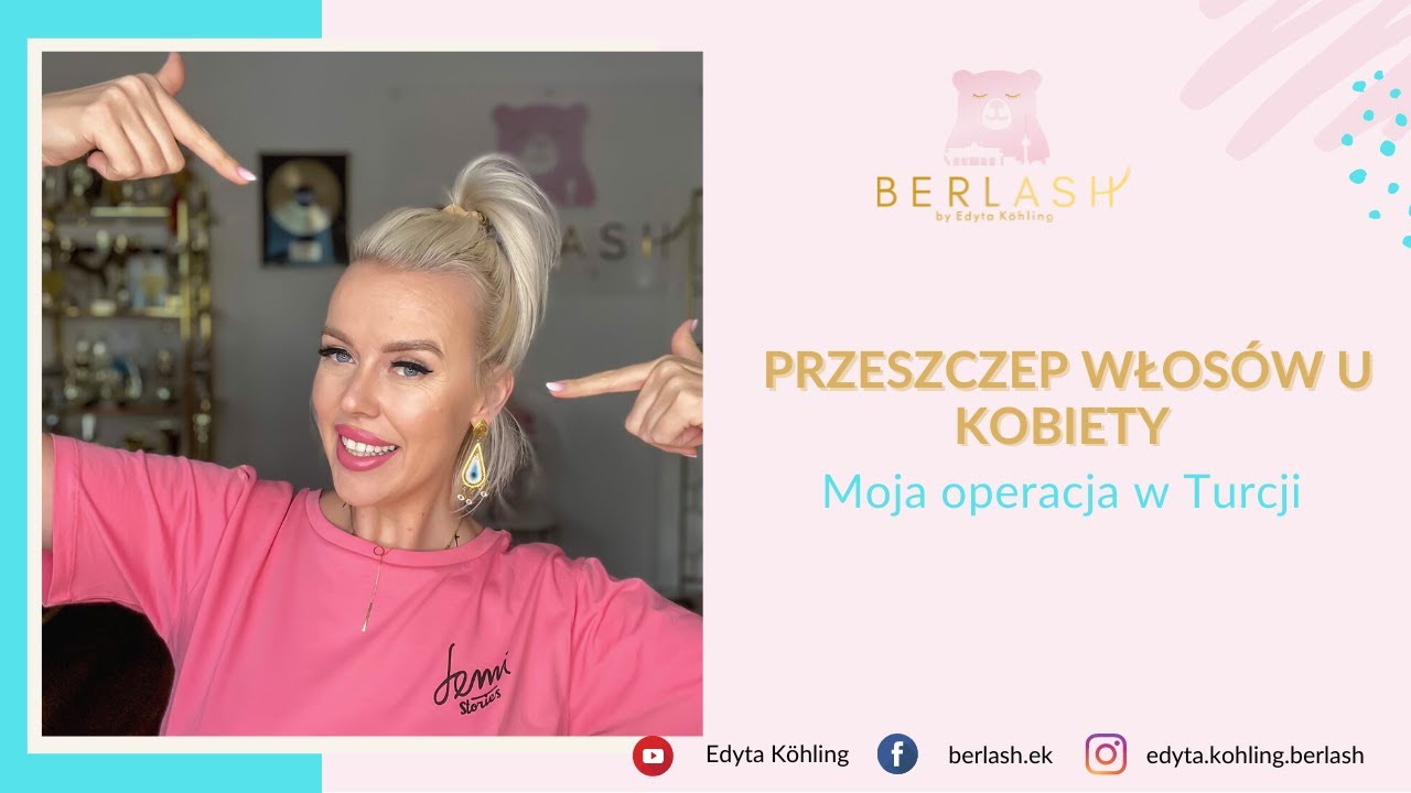 Przeszczep włosów u kobiety. Mój przeszczep włosów w Turcji w klinice Bank od Hair