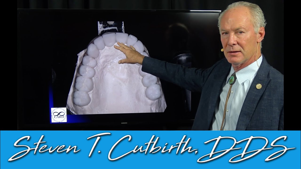 Veneers to Correct Mild to Moderate Crowding - Dental Minute with Steven T. Cutbirth, DDS