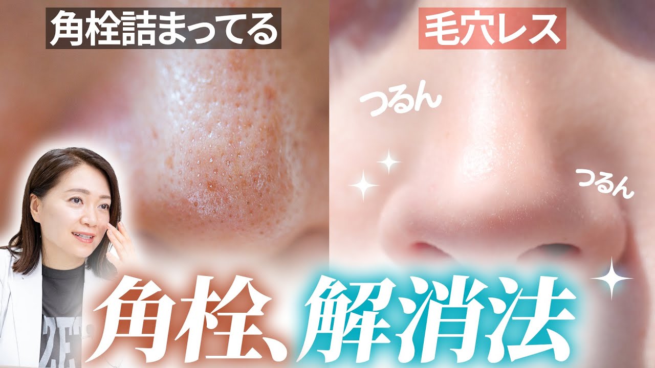 角栓を”終わらせる”3ステップを、2万人肌変えたプロが伝授