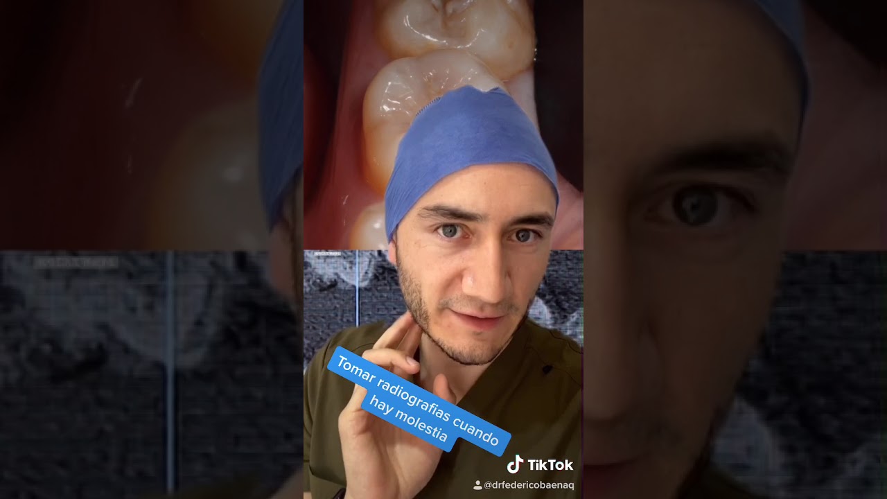 Eso pasa por no tomar radiografías a tiempo y no usar hilo dental. #shorts