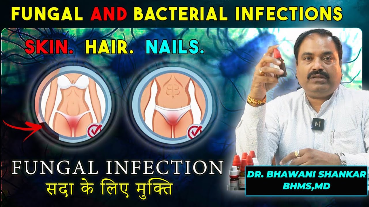 Fungal and Bacterial Infection in private part | Hair | Skin | Nail Homepathic medicine | Dr bhawani