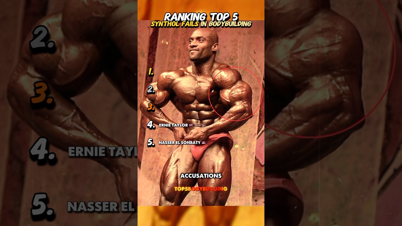 Ranking the Top 5 Synthol Fails 😬💉| 