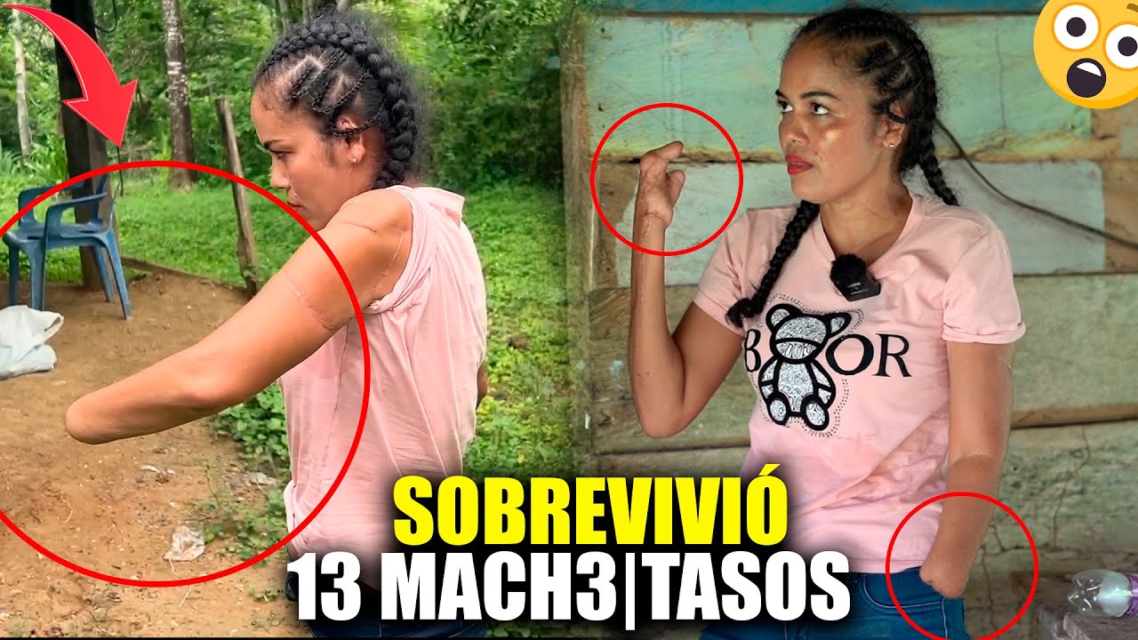 ELLA SOBREVIVIÓ A VARIOS MACHETASOS POR SU EX PAREJA 😞😱 QUEDO SIN MANOS 😞 EPISODIO 1/2