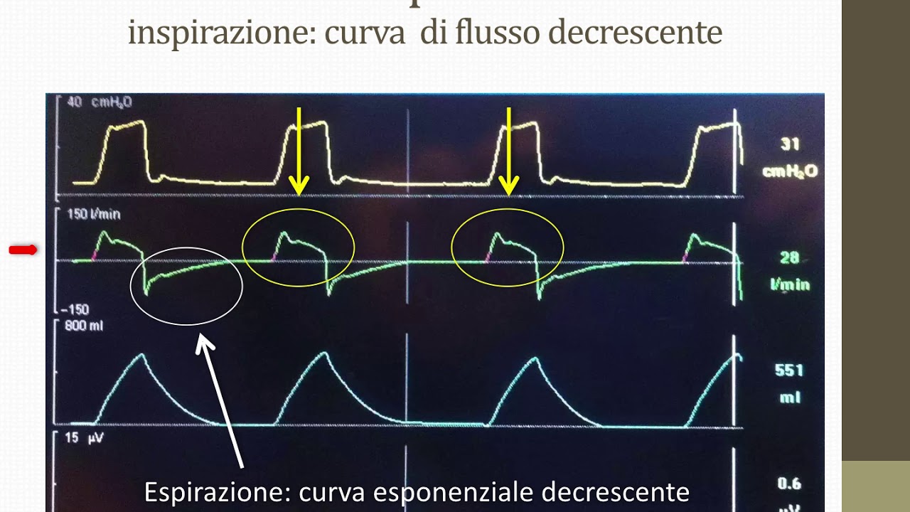 Meccanica Respiratoria - Adversi