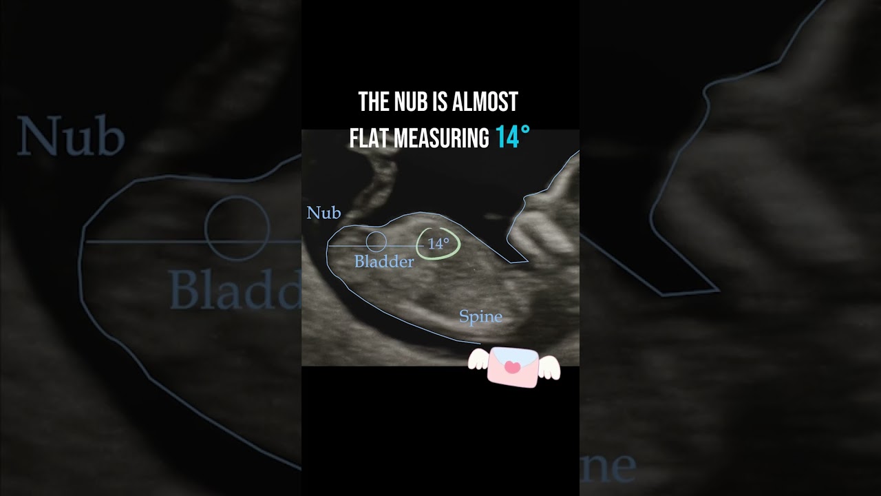 Gender reveal with NubX!