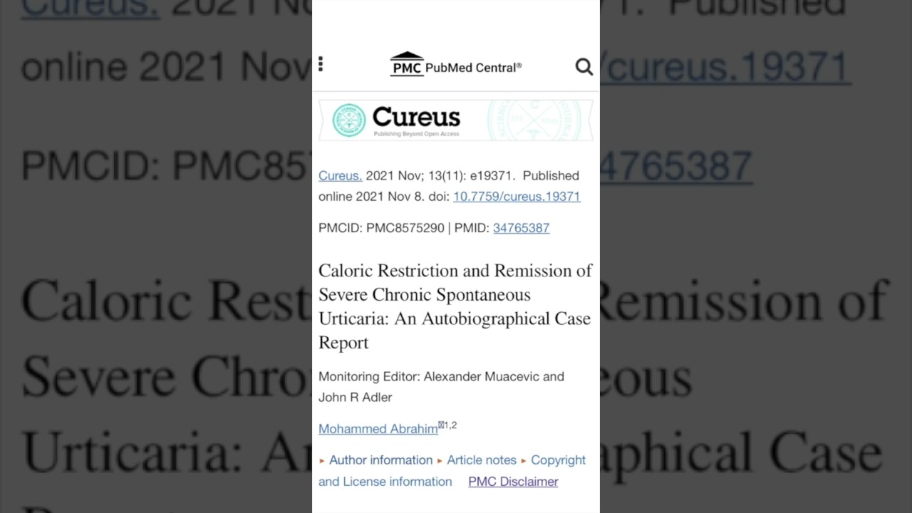 Weight loss and Remission of Chronic Urticaria