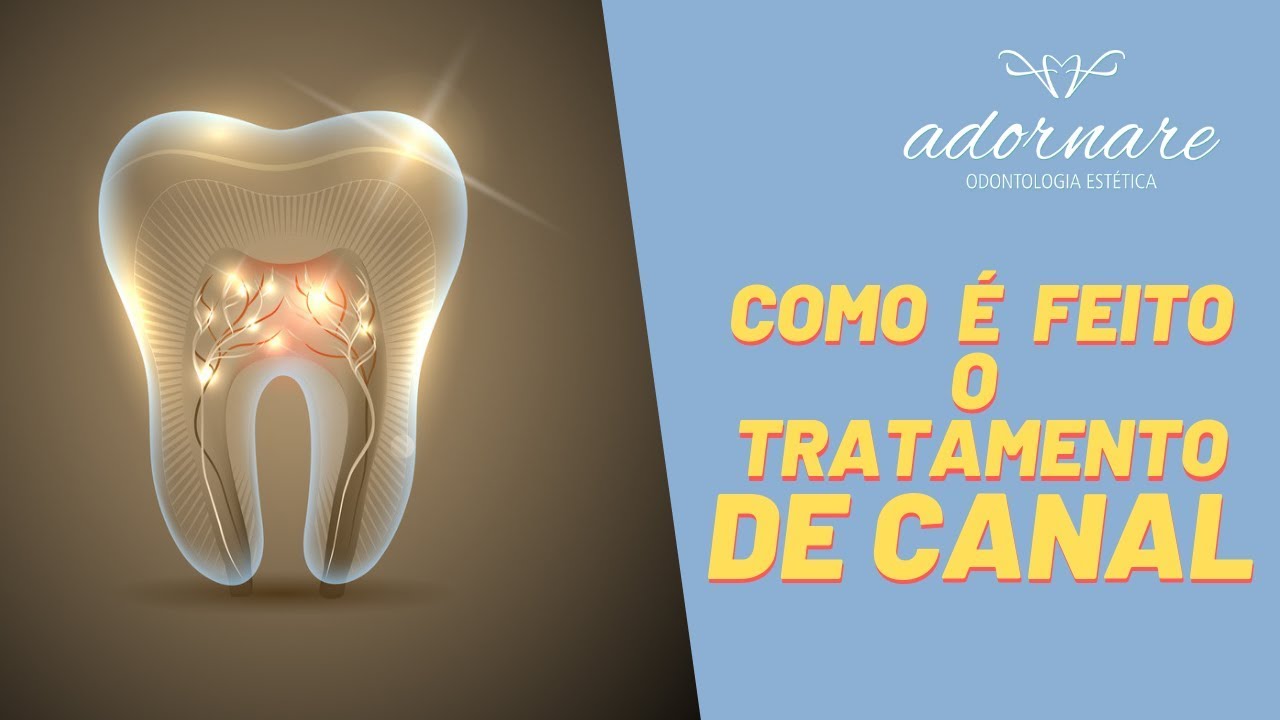 Como é Feito o Tratamento de Canal? - Dicas de Saúde Bucal