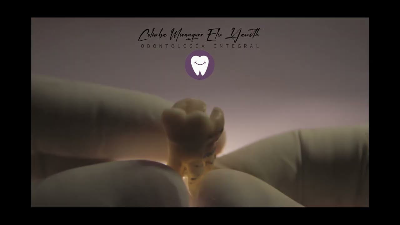 AS&Iacute; SE ELIMINA UNA AMLGAMA O EMPASTE DENTAL