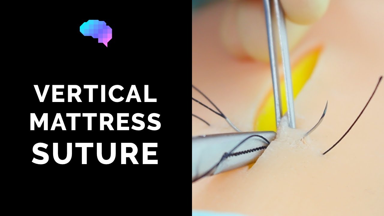Vertical Mattress Suture - OSCE Guide | UKMLA | CPSA | PLAB 2