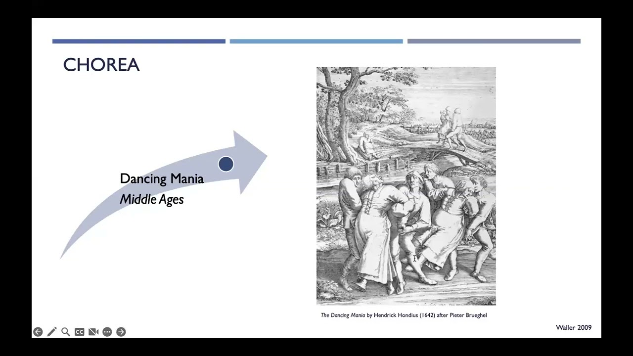 Storytelling in Movement Disorders with Alexa Lesenskyj DeArias