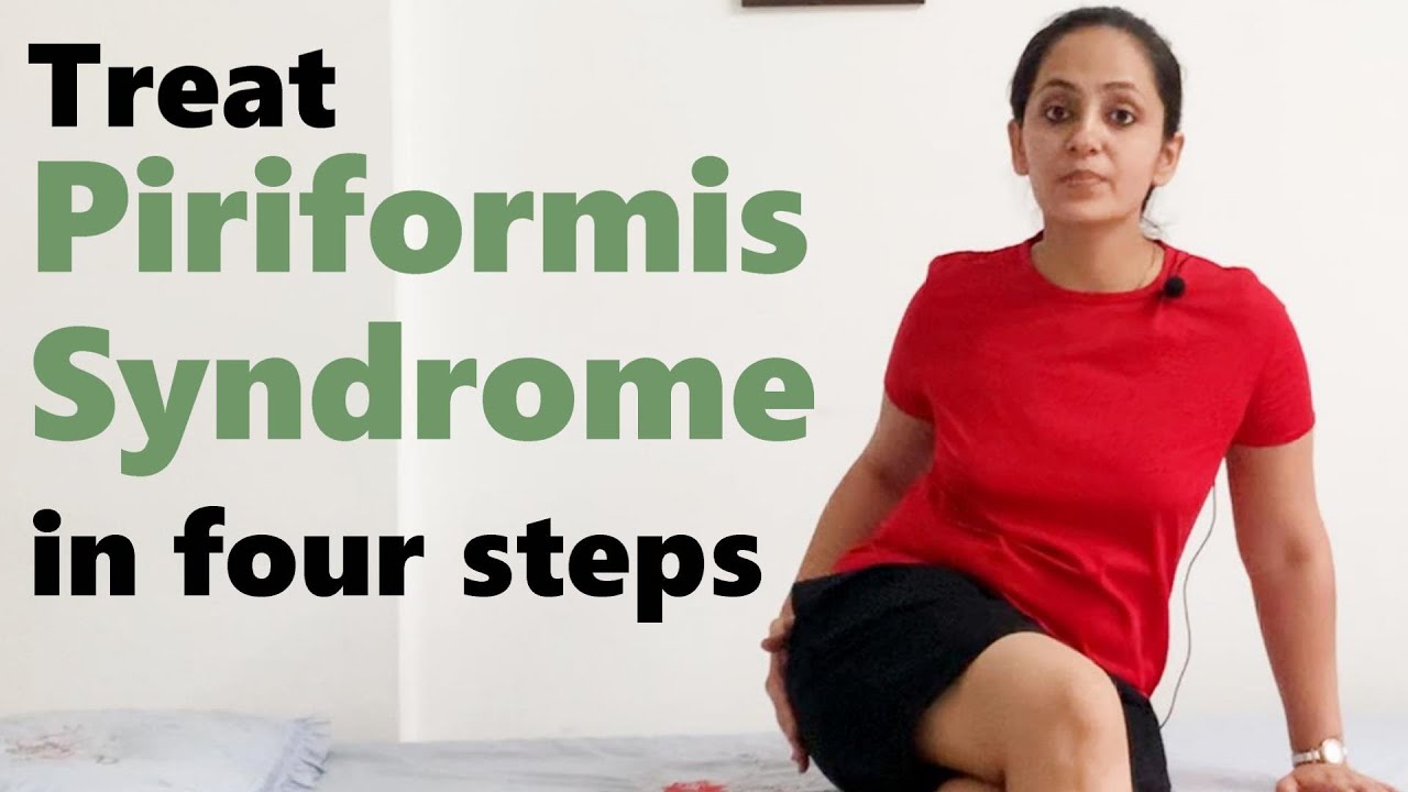 How to treat Piriformis Syndrome | Piriformis Syndrome Exercises in hindi