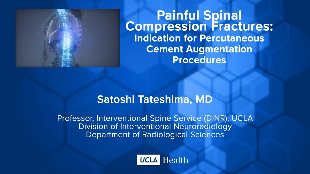 Painful Spinal Compression Fractures:Indication for Percutaneous Cement Augmentation Procedures