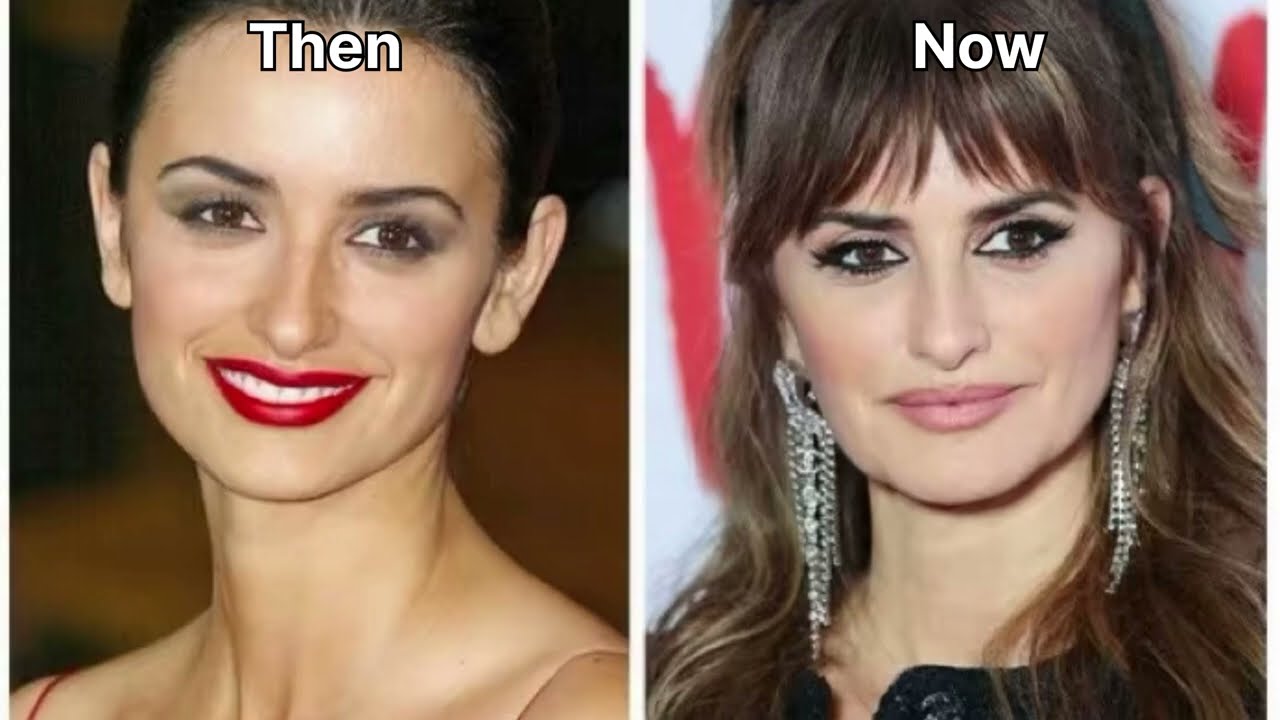 Celebrities  Before and After 