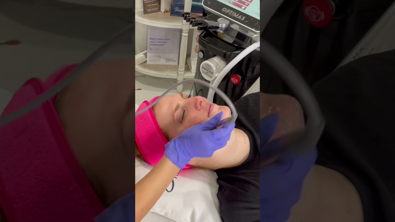 Forma Facial OC | Skin Heaven Aesthetics & Wellness #orangecounty #medspa #skinheavenmedspa #forma