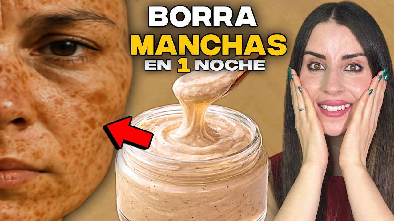 ESTO ME ACLARÓ EN 1 NOCHE Y ME QUITÓ LAS MANCHAS!