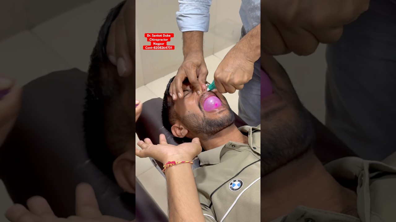 CFR for Vertigo & Migraine. #trend #ytshorts #shorts